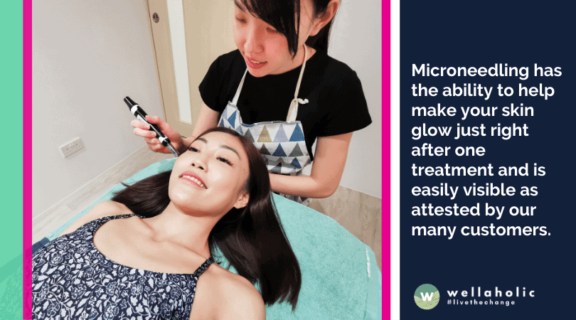 Microneedling has the ability to help make your skin glow just right after one treatment and is easily visible as attested by our many customers.