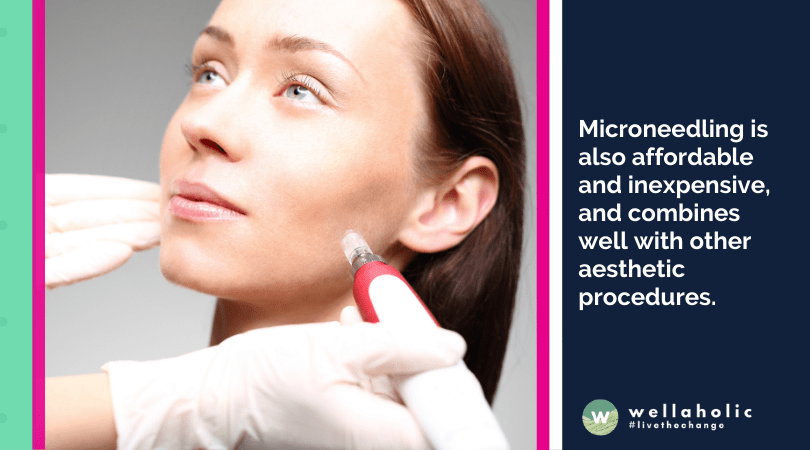 Microneedling is also affordable and inexpensive, and combines well with other aesthetic procedures.