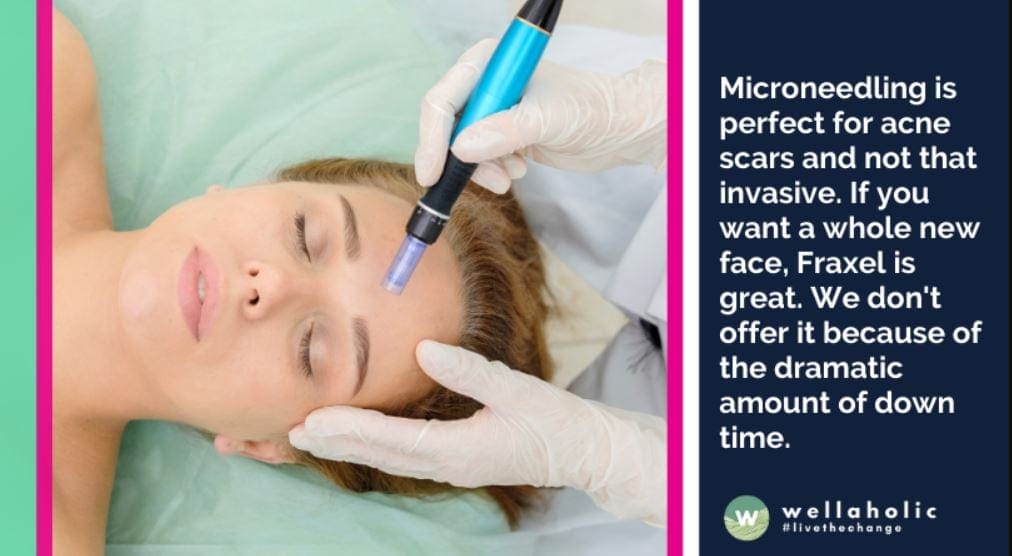Microneedling is perfect for acne scars and not that invasive. If you want a whole new face, Fraxel is great. We don't offer it because of the dramatic amount of down time.