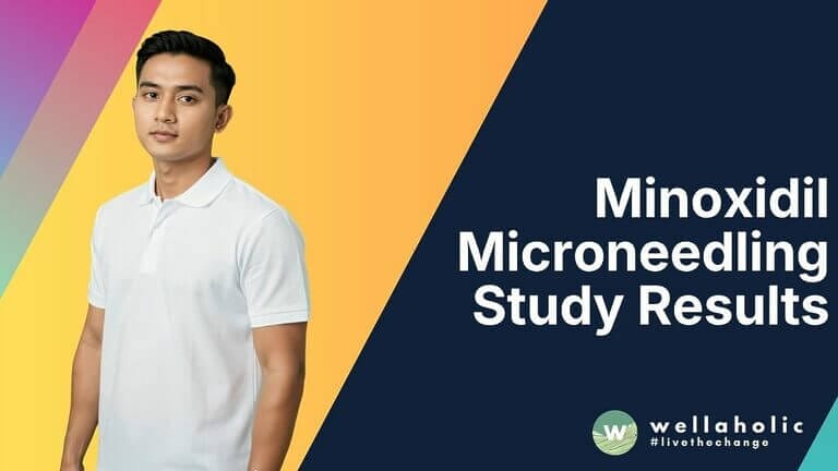 Minoxidil Microneedling Study Results