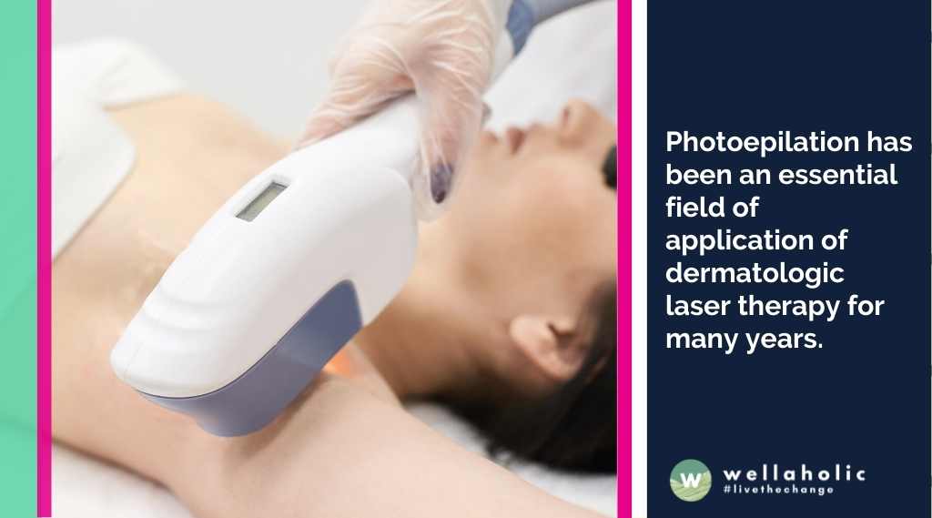 Photoepilation has been an essential field of application of dermatologic laser therapy for many years. 