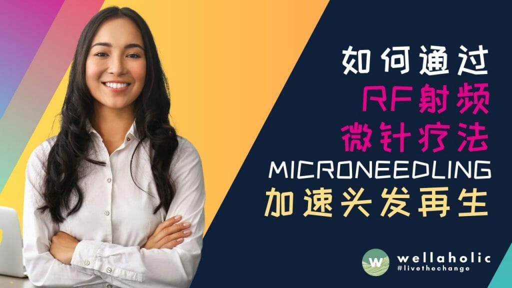 如何通过 RF 射频微针疗法 Microneedling 加速头发再生