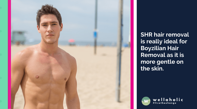 SHR hair removal is really ideal for Boyzilian Hair Removal as it is more gentle on the skin.