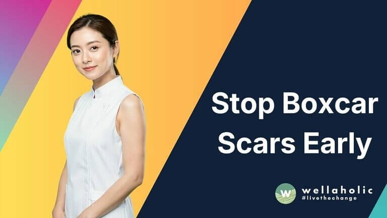 Stop Boxcar Scars Early (2)