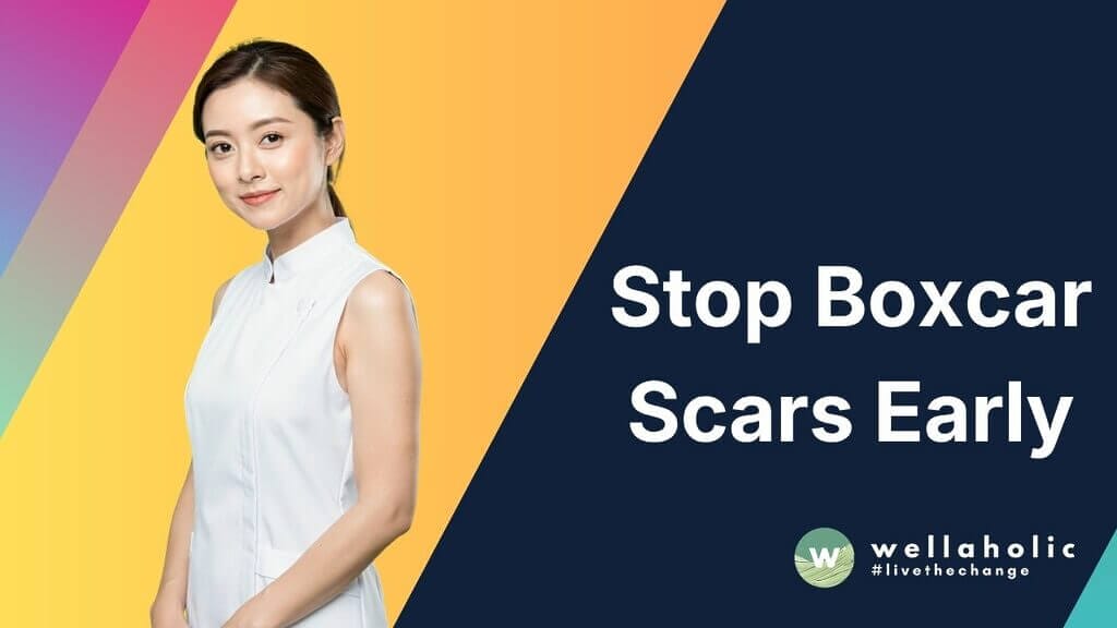 Stop Boxcar Scars Early (2)