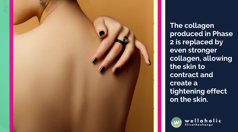 The collagen produced in Phase 2 is replaced by even stronger collagen, allowing the skin to contract and create a tightening effect on the skin. 