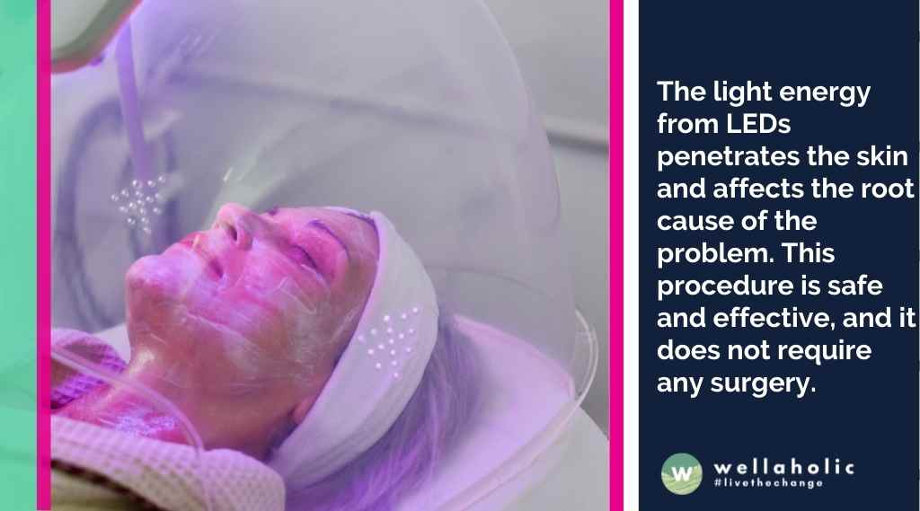 The light energy from LEDs penetrates the skin and affects the root cause of the problem. This procedure is safe and effective, and it does not require any surgery.