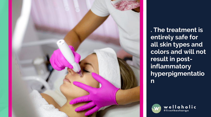 . The treatment is entirely safe for all skin types and colors and will not result in post-inflammatory hyperpigmentation