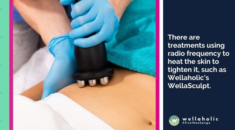 There are treatments using radio frequency to heat the skin to tighten it, such as Wellaholic's WellaSculpt. 