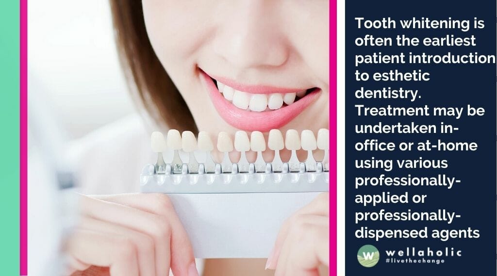 Tooth whitening is often the earliest patient introduction to esthetic dentistry. Treatment may be undertaken in-office or at-home using various professionally-applied or professionally-dispensed agents, or one of the self-directed whitening systems