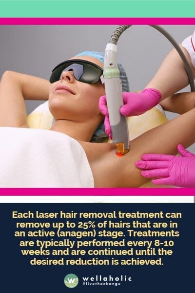 Each laser hair removal treatment can remove up to 25% of hairs that are in an active (anagen) stage. Treatments are typically performed every 8-10 weeks and are continued until the desired reduction is achieved.