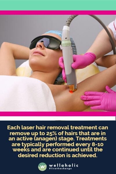 Each laser hair removal treatment can remove up to 25% of hairs that are in an active (anagen) stage. Treatments are typically performed every 8-10 weeks and are continued until the desired reduction is achieved.