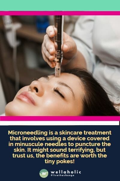 Microneedling is a skincare treatment that involves using a device covered in minuscule needles to puncture the skin. It might sound terrifying, but trust us, the benefits are worth the tiny pokes!