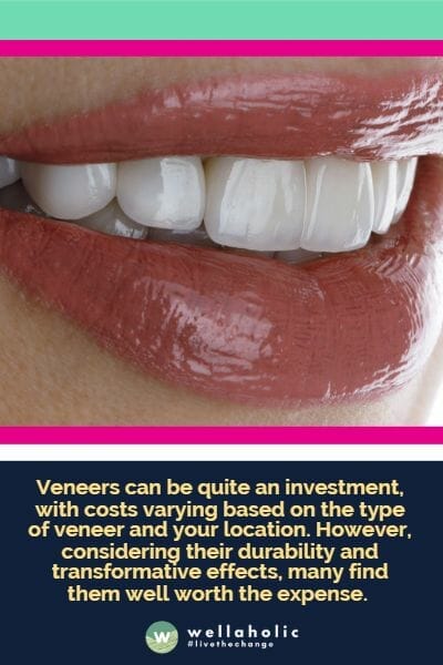 Veneers can be quite an investment, with costs varying based on the type of veneer and your location. However, considering their durability and transformative effects, many find them well worth the expense. 