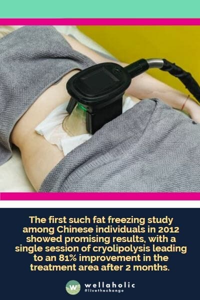 The first such fat freezing study among Chinese individuals in 2012 showed promising results, with a single session of cryolipolysis leading to an 81% improvement in the treatment area after 2 months.