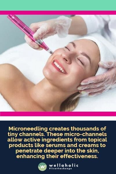 微针美容疗法创造了成千上万个微小通道。这些微通道让来自补水精华液和面霜等局部产品中的活性成分更深层次地渗透皮肤，增强了它们的功效。