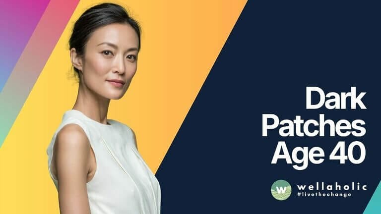 Dark Patches Age 40