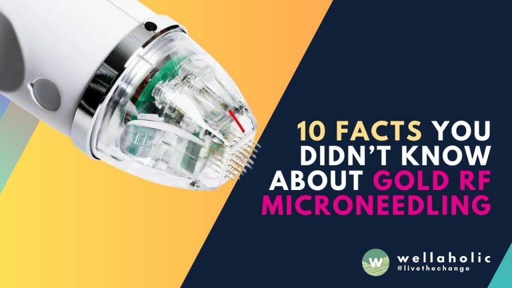 Discover 10 mind-blowing facts about Gold RF Microneedling that will leave you amazed! Uncover the secret to rejuvenated and glowing skin. Click now to unveil the golden beauty!