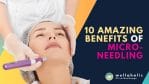 "Discover the 10 amazing benefits of microneedling and transform your skin! From reducing wrinkles to improving texture, microneedling is a game-changer. Don't miss out on these incredible advantages - Read on to unlock the secrets to youthful, radiant skin!