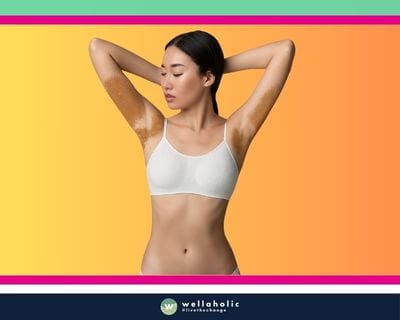 Hyperpigmentation can appear as dark spots or patches on the treated area, caused by an excess production of melanin