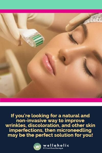 . If you're looking for a natural and non-invasive way to improve wrinkles, discoloration, and other skin imperfections, then microneedling may be the perfect solution for you!