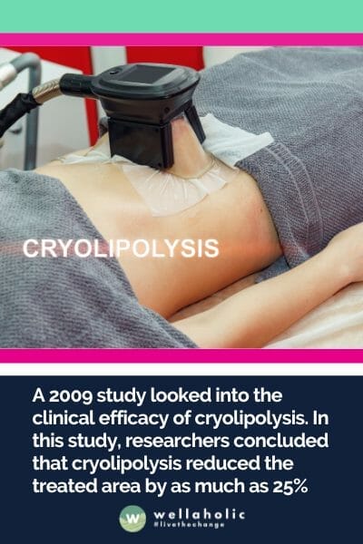 A 2009 study looked into the clinical efficacy of cryolipolysis. In this study, researchers concluded that cryolipolysis reduced the treated area by as much as 25%