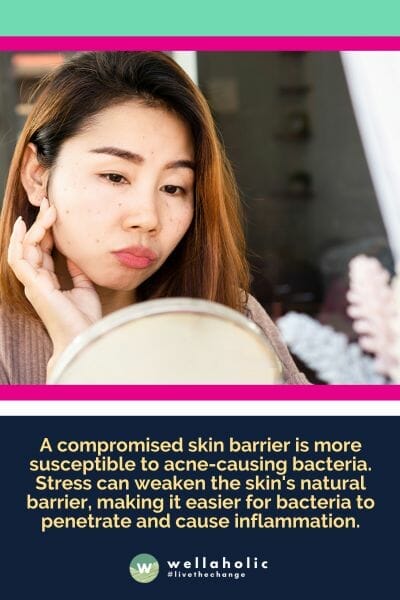 A compromised skin barrier is more susceptible to acne-causing bacteria. Stress can weaken the skin's natural barrier, making it easier for bacteria to penetrate and cause inflammation.