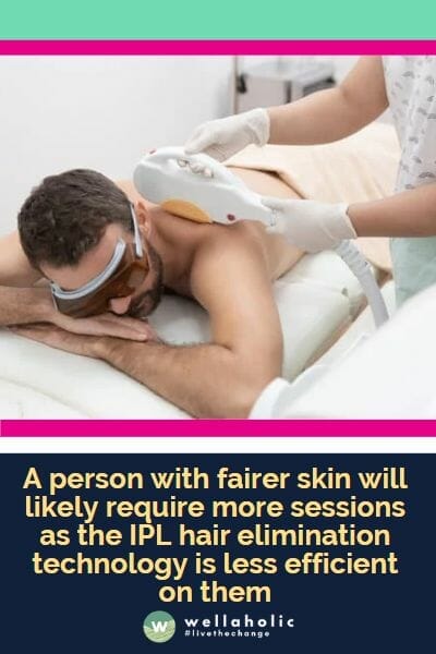 A person with fairer skin will likely require more sessions as the IPL hair elimination technology is less efficient on them
