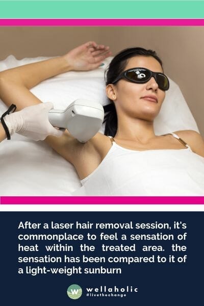 After a laser hair removal session, it's commonplace to feel a sensation of heat within the treated area. the sensation has been compared to it of a light-weight sunburn