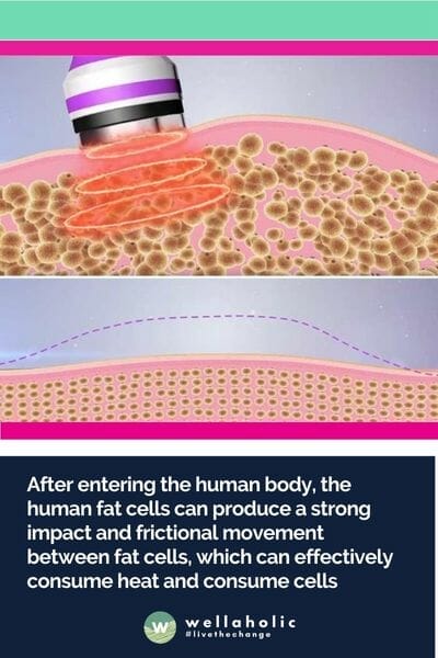 After entering the human body, the human fat cells can produce a strong impact and frictional movement between fat cells, which can effectively consume heat and consume cells