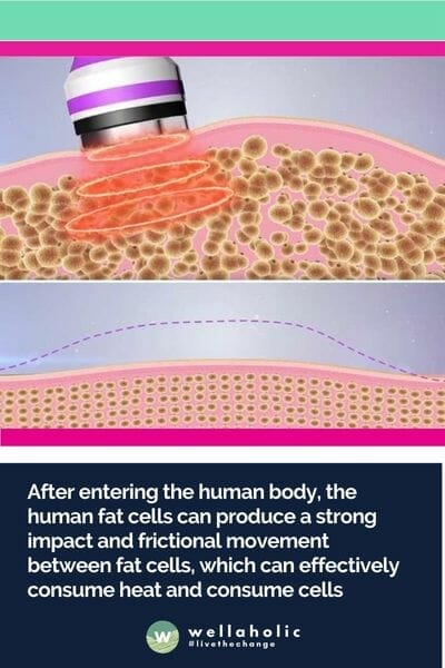 After entering the human body, the human fat cells can produce a strong impact and frictional movement between fat cells, which can effectively consume heat and consume cells