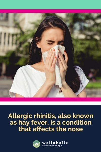 Allergic rhinitis, also known as hay fever, is a condition that affects the nose