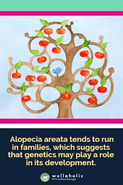  Alopecia areata tends to run in families, which suggests that genetics may play a role in its development.