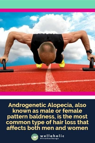 Androgenetic Alopecia, also known as male or female pattern baldness, is the most common type of hair loss that affects both men and women