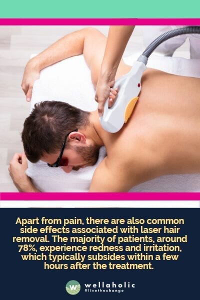 Apart from pain, there are also common side effects associated with laser hair removal. The majority of patients, around 78%, experience redness and irritation, which typically subsides within a few hours after the treatment.