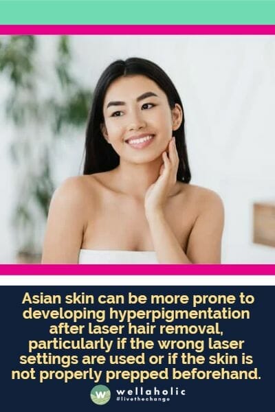  Asian skin can be more prone to developing hyperpigmentation after laser hair removal, particularly if the wrong laser settings are used or if the skin is not properly prepped beforehand.