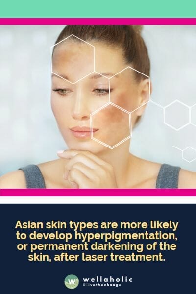 Asian skin types are more likely to develop hyperpigmentation, or permanent darkening of the skin, after laser treatment.