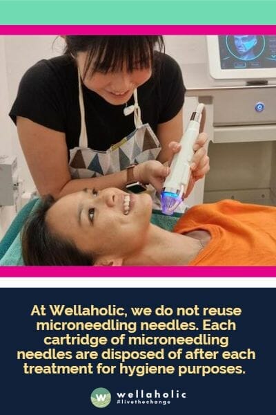 在Wellaholic，我们不会重复使用微针美容的针头。每个微针美容的针头都会在每次治疗后进行处理，以确保卫生。