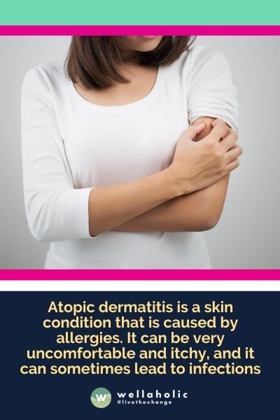 Atopic dermatitis is a skin condition that is caused by allergies. It can be very uncomfortable and itchy, and it can sometimes lead to infections