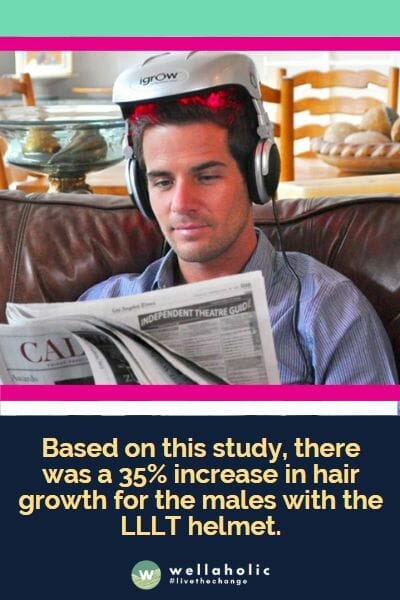 Based on this study, there was a 35% increase in hair growth for the males with the LLLT helmet.