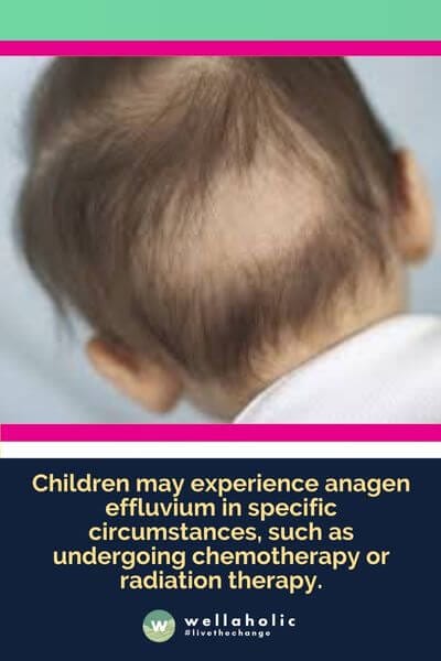Children may experience anagen effluvium in specific circumstances, such as undergoing chemotherapy or radiation therapy. 