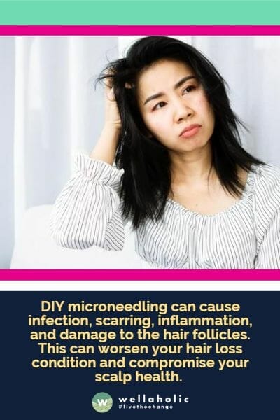 DIY microneedling can cause infection, scarring, inflammation, and damage to the hair follicles. This can worsen your hair loss condition and compromise your scalp health.