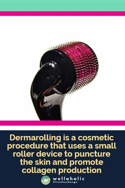 Dermarolling is a cosmetic procedure that uses a small roller device to puncture the skin and promote collagen production