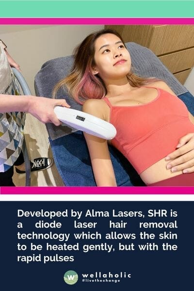 SHR是由 Alma Lasers 开发的二极管激光脱毛技术，可以轻柔地加热皮肤，并快速脉冲。