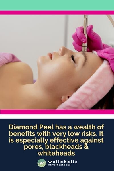 Diamond Peel has a wealth of benefits with very low risks. It is especially effective against pores, blackheads & whiteheads