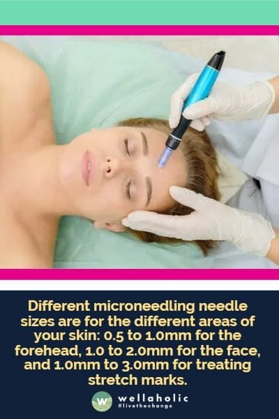 Different needle sizes are for the different areas of your skin: 0.5 to 1.0mm for the forehead, 1.0 to 2.0mm for the face, and 1.0mm to 3.0mm for treating stretch marks.