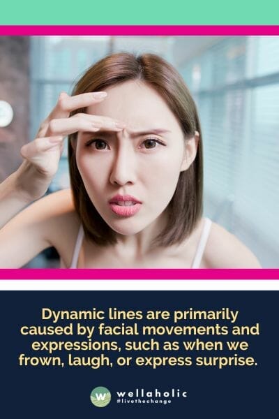Dynamic lines are primarily caused by facial movements and expressions, such as when we frown, laugh, or express surprise. 