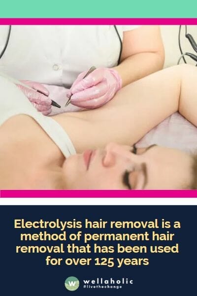 Electrolysis hair removal is a method of permanent hair removal that has been used for over 125 years
