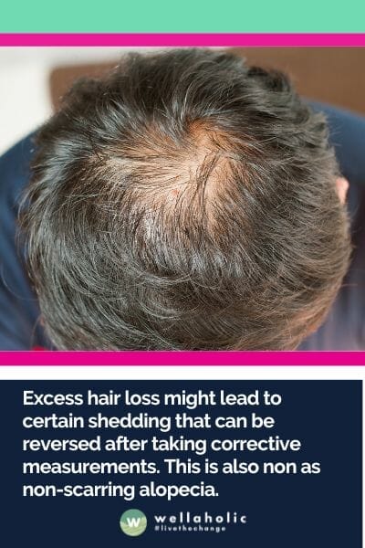 Excess hair loss might lead to certain shedding that can be reversed after taking corrective measurements. This is also non as non-scarring alopecia. 