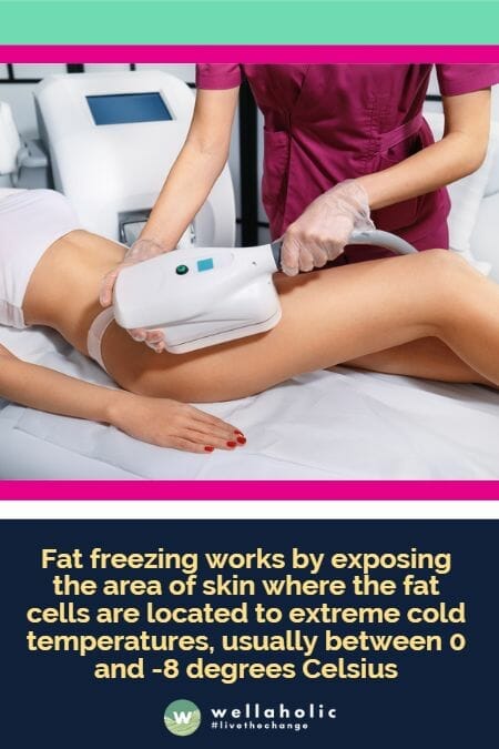 Fat freezing works by exposing the area of skin where the fat cells are located to extreme cold temperatures, usually between 0 and -8 degrees Celsius